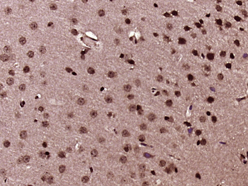 KDM6A Rabbit Polyclonal Antibody