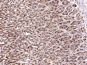 KDM6A Rabbit Polyclonal Antibody