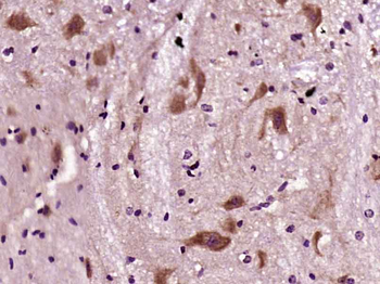 KIF20B Rabbit Polyclonal Antibody