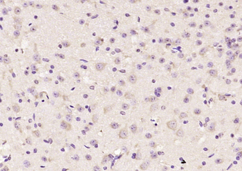 KIF2A Rabbit Polyclonal Antibody