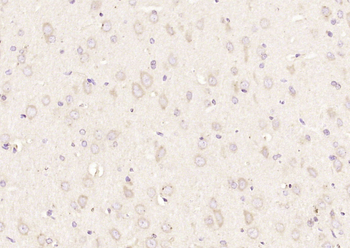 KIF2A Rabbit Polyclonal Antibody