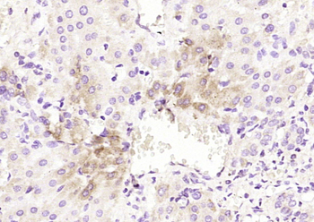 Kindlin Rabbit Polyclonal Antibody