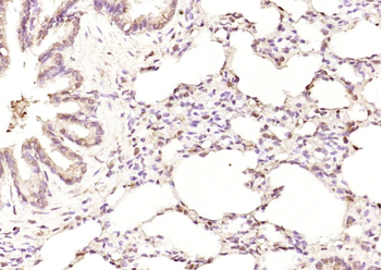 Karyopherin beta 3 Rabbit Polyclonal Antibody