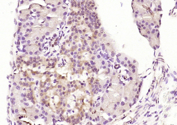 Karyopherin beta 3 Rabbit Polyclonal Antibody