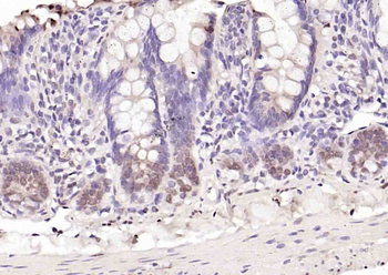 Phospho-KAT5 (Ser86) Rabbit Polyclonal Antibody