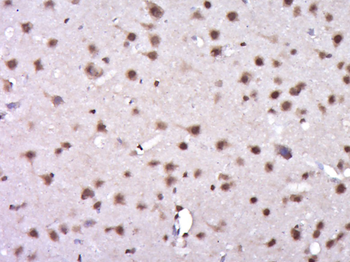 Phospho-KAT5 (Ser86) Rabbit Polyclonal Antibody