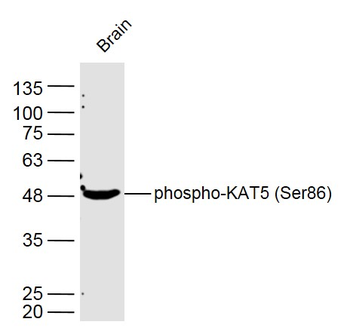Phospho-KAT5 (Ser86) Rabbit Polyclonal Antibody