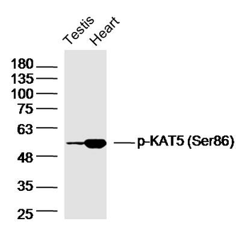 Phospho-KAT5 (Ser86) Rabbit Polyclonal Antibody