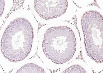 Phospho-TRIM28 (Ser473) Rabbit Polyclonal Antibody