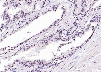 Phospho-TRIM28 (Ser473) Rabbit Polyclonal Antibody