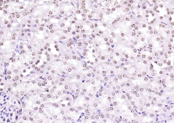 Phospho-TRIM28 (Ser473) Rabbit Polyclonal Antibody