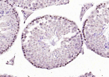 Phospho-TRIM28 (Ser473) Rabbit Polyclonal Antibody