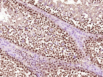 Phospho-TRIM28 (Ser473) Rabbit Polyclonal Antibody