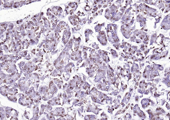 Phospho-ALOX5 (Ser524) Rabbit Polyclonal Antibody