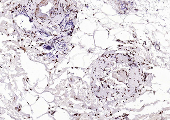 Phospho-ALOX5 (Ser524) Rabbit Polyclonal Antibody