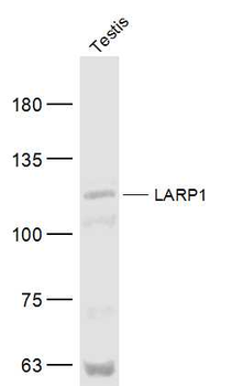 LARP1 Rabbit Polyclonal Antibody