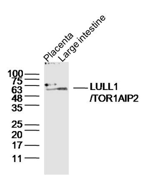 LULL1/TOR1AIP2 Rabbit Polyclonal Antibody