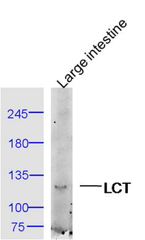 LCT Rabbit Polyclonal Antibody