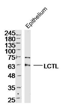 LCTL Rabbit Polyclonal Antibody