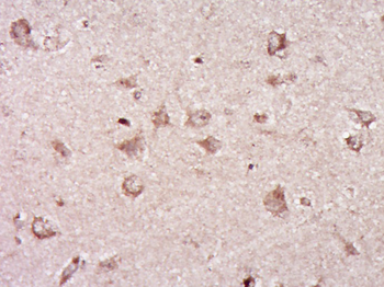 LGALS9B Rabbit Polyclonal Antibody