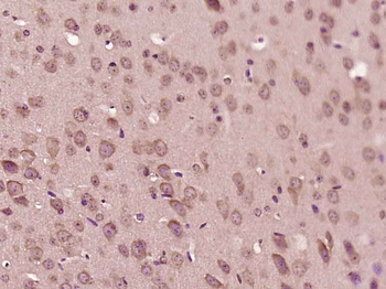 LGI2 Rabbit Polyclonal Antibody