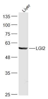 LGI2 Rabbit Polyclonal Antibody