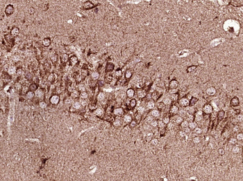 Phospho-LIM Kinase 1 (Thr508) Rabbit Polyclonal Antibody