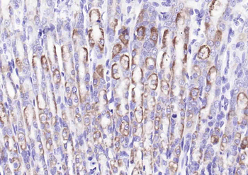 Phospho-LIM Kinase 1 (Thr508) Rabbit Polyclonal Antibody