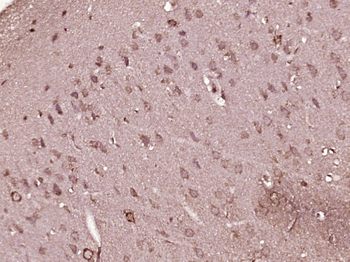 Phospho-LIM Kinase 1 (Thr508) Rabbit Polyclonal Antibody