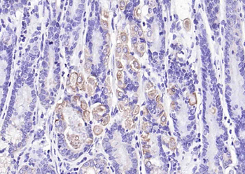 Phospho-LIM Kinase 1 (Thr508) Rabbit Polyclonal Antibody