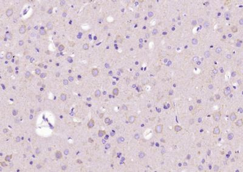 Phospho-LIM Kinase 2 (Thr505) Rabbit Polyclonal Antibody