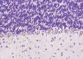 Phospho-LIM Kinase 2 (Thr505) Rabbit Polyclonal Antibody