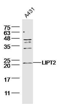 LIPT2 Rabbit Polyclonal Antibody