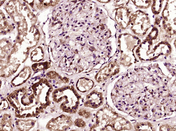 LYPLA3 Rabbit Polyclonal Antibody