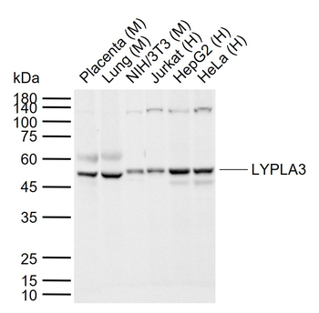 LYPLA3 Rabbit Polyclonal Antibody