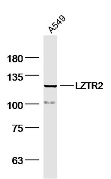 LZTR2 Rabbit Polyclonal Antibody