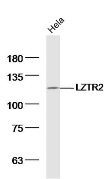 LZTR2 Rabbit Polyclonal Antibody