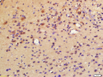 LPCAT2 Rabbit Polyclonal Antibody