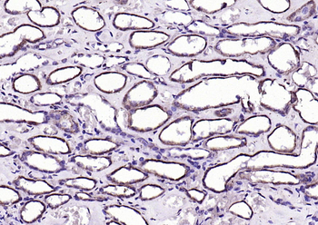 Phospho-MST4 + MST3 + STK25 (Thr178 + Thr190 + Thr174) Rabbit Polyclonal Antibody