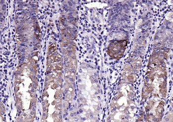 Phospho-MST4 + MST3 + STK25 (Thr178 + Thr190 + Thr174) Rabbit Polyclonal Antibody