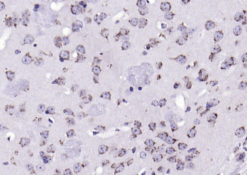 Phospho-MST4 + MST3 + STK25 (Thr178 + Thr190 + Thr174) Rabbit Polyclonal Antibody