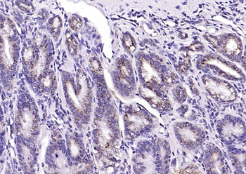 Phospho-MST4 + MST3 + STK25 (Thr178 + Thr190 + Thr174) Rabbit Polyclonal Antibody