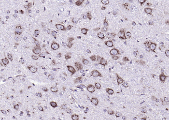 Phospho-MST4 + MST3 + STK25 (Thr178 + Thr190 + Thr174) Rabbit Polyclonal Antibody