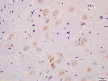 Phospho-MST4 + MST3 + STK25 (Thr178 + Thr190 + Thr174) Rabbit Polyclonal Antibody