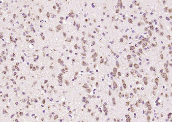 Phospho-MST3 (Thr178) Rabbit Polyclonal Antibody