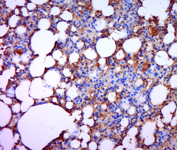 MMP13 Rabbit Polyclonal Antibody