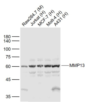 MMP13 Rabbit Polyclonal Antibody