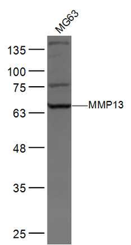 MMP13 Rabbit Polyclonal Antibody