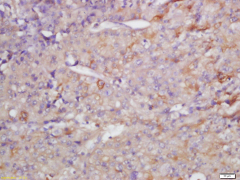 MMP13 Rabbit Polyclonal Antibody