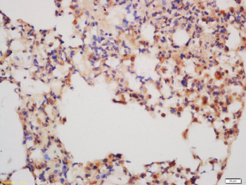 MMP13 Rabbit Polyclonal Antibody